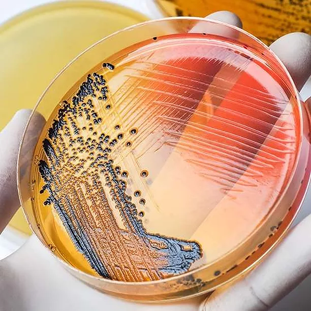 Formation : AGENTS BIOLOGIQUES ET RISQUES ASSOCIÉS