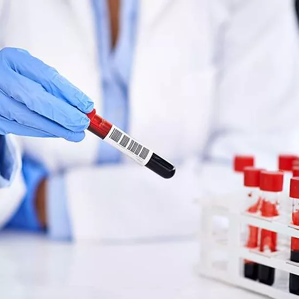 Formation : PRODUITS D’ORIGINE HUMAINE ET RISQUES BIOLOGIQUES